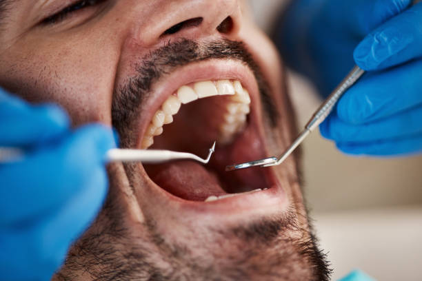 Best Broken or Cracked Tooth Emergency Dentist in Fraser, CO